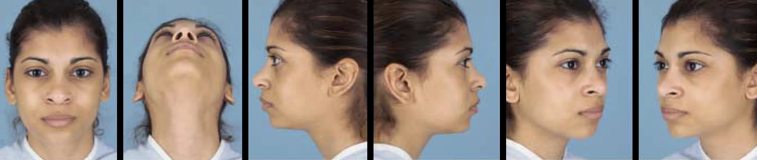 simulação 6 fotografias